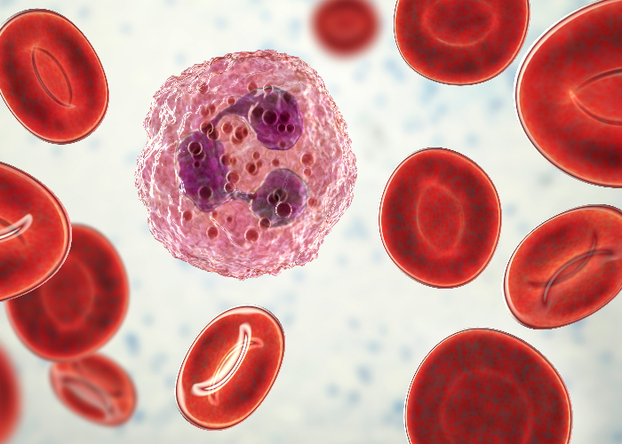 messenger molecules, ms risk genes and a potential new diagnosis tool