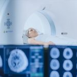 Towards better monitoring of MS using MRI measures