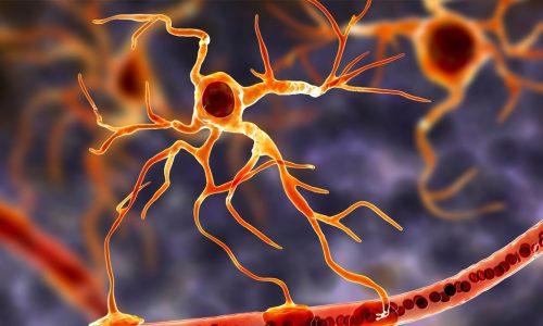 Researchers develop a cutting-edge tool to identify rare brain cells linked to MS.