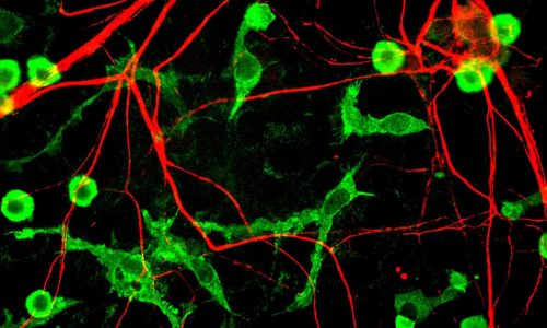 aze-microglia