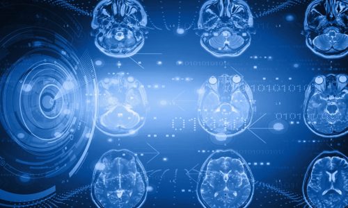 mri-ai