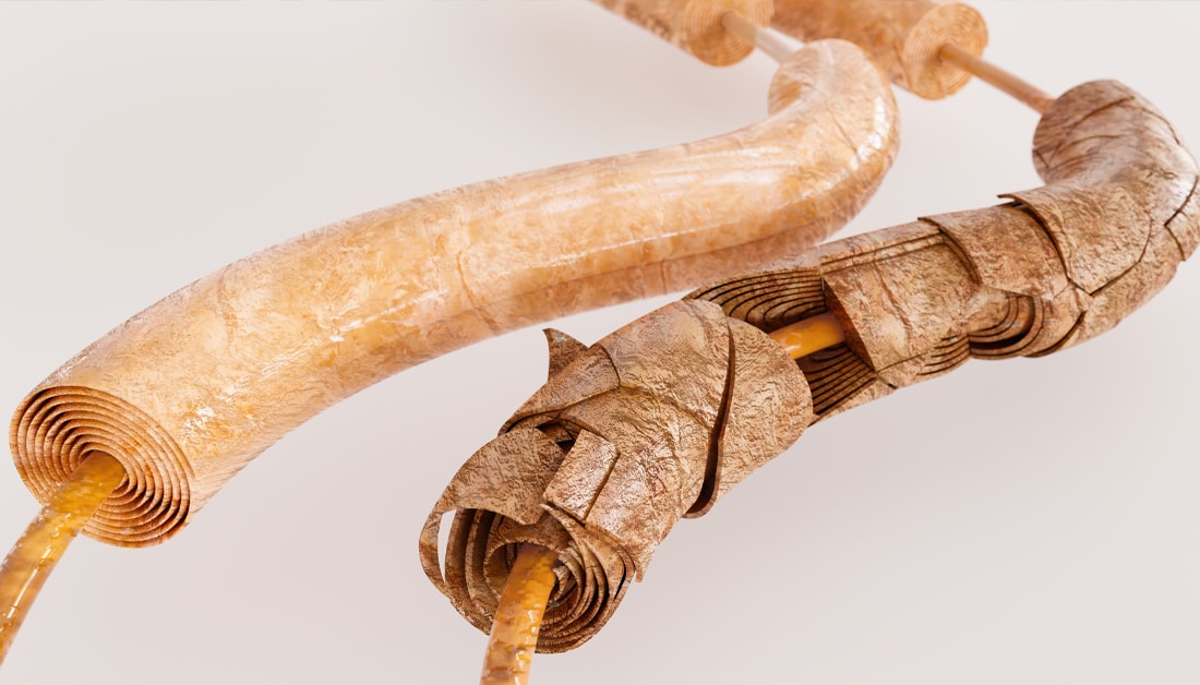 Therapeutic protein shows promise in regenerating nerve fibres and myelin repair