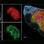 Newly identified molecules could explain the protective effect of UV light in MS