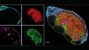 Newly identified molecules could explain the protective effect of UV light in MS