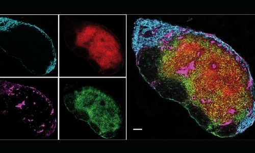 Newly identified molecules could explain the protective effect of UV light in MS