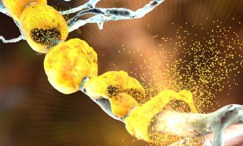 What triggers the immune response against myelin in MS?